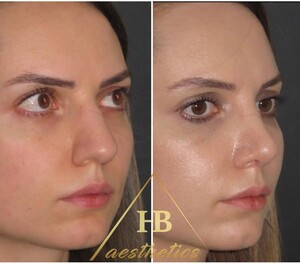 Image of HB Aesthetics - Dr. Hakan BULAM Gallery 1