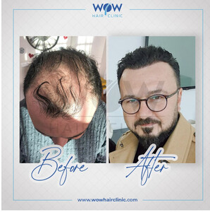 Image of WoW Hair Clinic Gallery 0