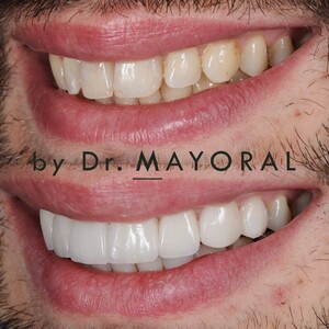 Image of Barcelona Smile Center by Dr. Mayoral Gallery 3