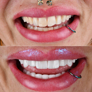 Image of Creative Smiles Turkey (CS) Dental Clinic Gallery 1