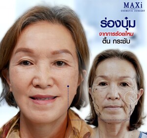 Image of MAXi Cosmetic Surgery Gallery 3