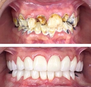 Image of Smile makeover