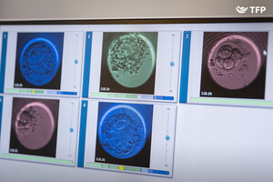 Image of TFP Fertility Vitrolive Gallery 1