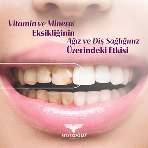 Image of Mısıroğlu Exclusive Dental Studio Gallery 2