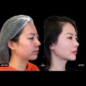 Image of Facial plastic surgery