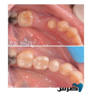 Image of Ders Dental Clinic Gallery 2