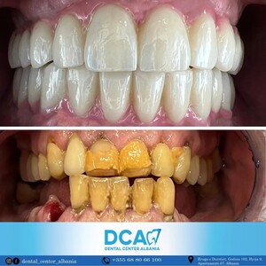 Image of DCA - Dental Center Albania Gallery 0