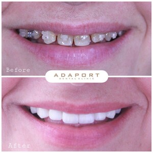 Image of Adaport Dental Clinic Gallery 0