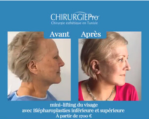 Image of ChirurgiePro - Chirurgie esthétique en Tunisie Gallery 2