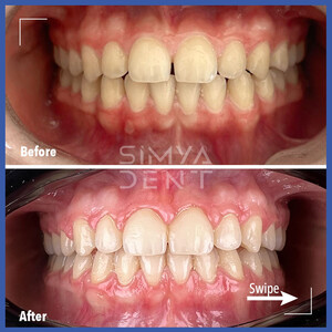 Image of SimyaDent Dental Clinic Gallery 1