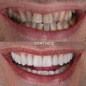 Image of Smile makeover