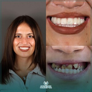 Image of Andepol - Antalya Dental Polyclinic Gallery 3