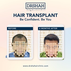 Image of Dr Shah Specialist Hair Loss Clinic Gallery 0