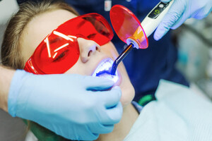 Image of Teeth whitening - LLL Dental