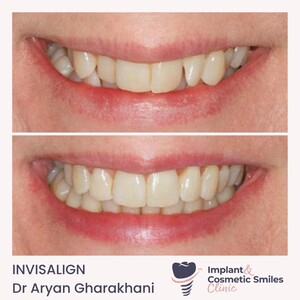 Image of The Implant and Cosmetic Smiles Clinic Gallery 0