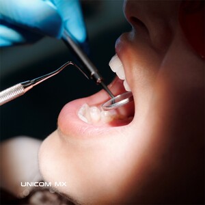 Image of Teeth cleaning