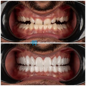 Image of Medic Antalya Dental Clinic Gallery 1