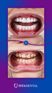 Image of Istadental - Istanbul Dental Aesthetic Clinic Gallery 6