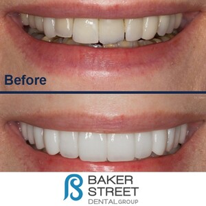 Image of Baker Street Dental Gallery 1