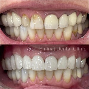 Image of Eminaj Dental Clinic Gallery 3