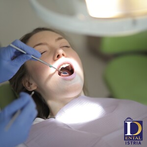 Image of Teeth cleaning - Dental Fiume