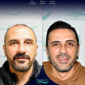 Image of HairextreM Hairtransplant Center Gallery 1