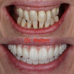 Image of Dental treatment before and after