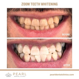 Image of Pearl Dental Clinic - Dubai Gallery 3