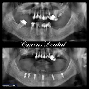 Image of Cyprus Dental Surgery Gallery 0