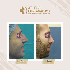 Image of Athens Face Anatomy - Dr. Argyro Kypraiou Gallery 2