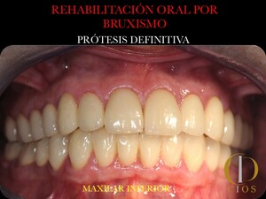 Image of Seville Oral Implantology Center Gallery 2