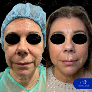 Image of Facial plastic surgery