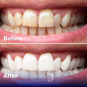 Image of Smile makeover