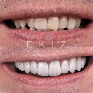 Image of Ekiz Dental Clinic Gallery 2