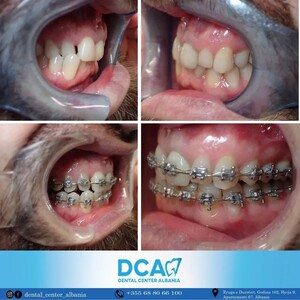 Image of DCA - Dental Center Albania Gallery 2