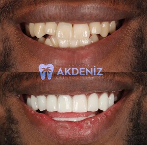 Image of Antalya Akdeniz Dental Clinic Gallery 2