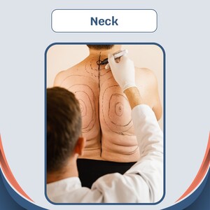 Image of Neck Lift - Cauris Health