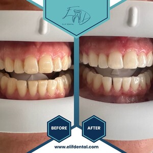 Image of Elif Dental Clinic Gallery 3