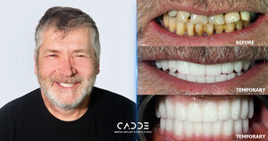 Image of Cadde Dental Gallery 1