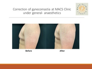 Image of MACS Cosmetic Clinic (Harley Street) Gallery 0