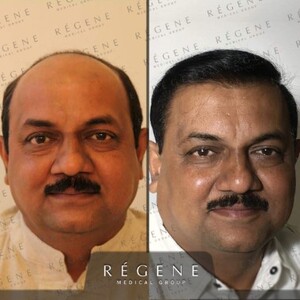 Image of Regene Medical Group Gallery 3