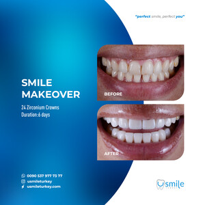 Image of U Smile Turkey Dental Clinic Gallery 3