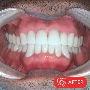 Image of Smile makeover