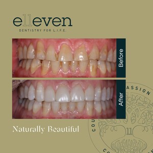 Image of Elleven Dental Gallery 0