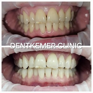 Image of Dentkemer Dental Clinic Gallery 2