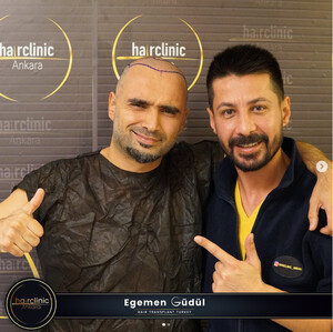 Image of Egemen Güdül Hair Clinic Ankara Gallery 1