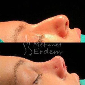 Image of Op. Dr. Mehmet Erdem Clinic Gallery 0