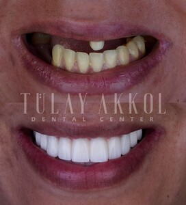 Image of Tülay Akkol Dental Center Gallery 3