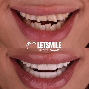 Image of Letsmile Turkiye Gallery 0