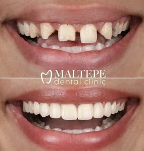 Image of Maltepe Dental Clinic Gallery 2